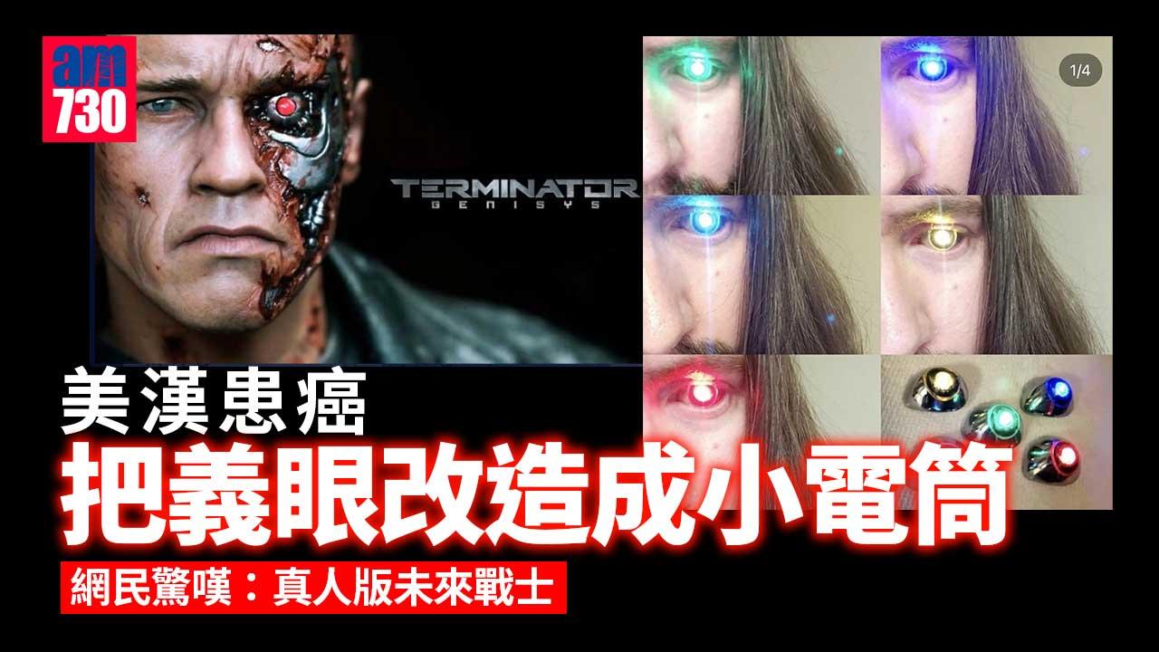 美漢患癌失去左眼 改造義眼成「迷幻電筒」網民驚嘆：真人版未來戰士