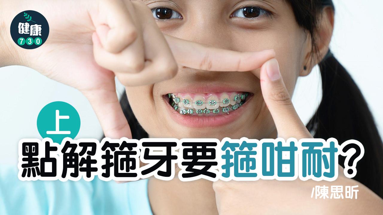 點解箍牙要箍咁耐？(上)