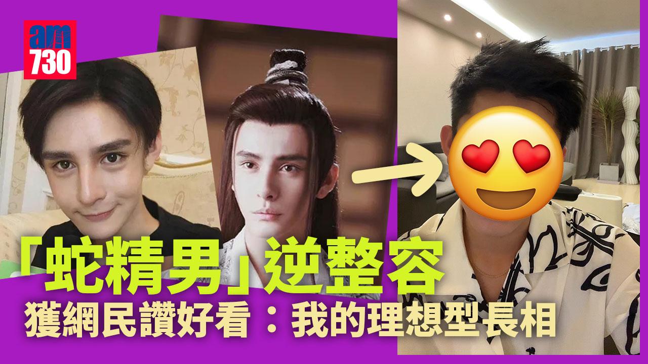 內地男星林皓洋「蛇精男」逆整容 被激讚五官自然又靚仔：是我的理想型長相