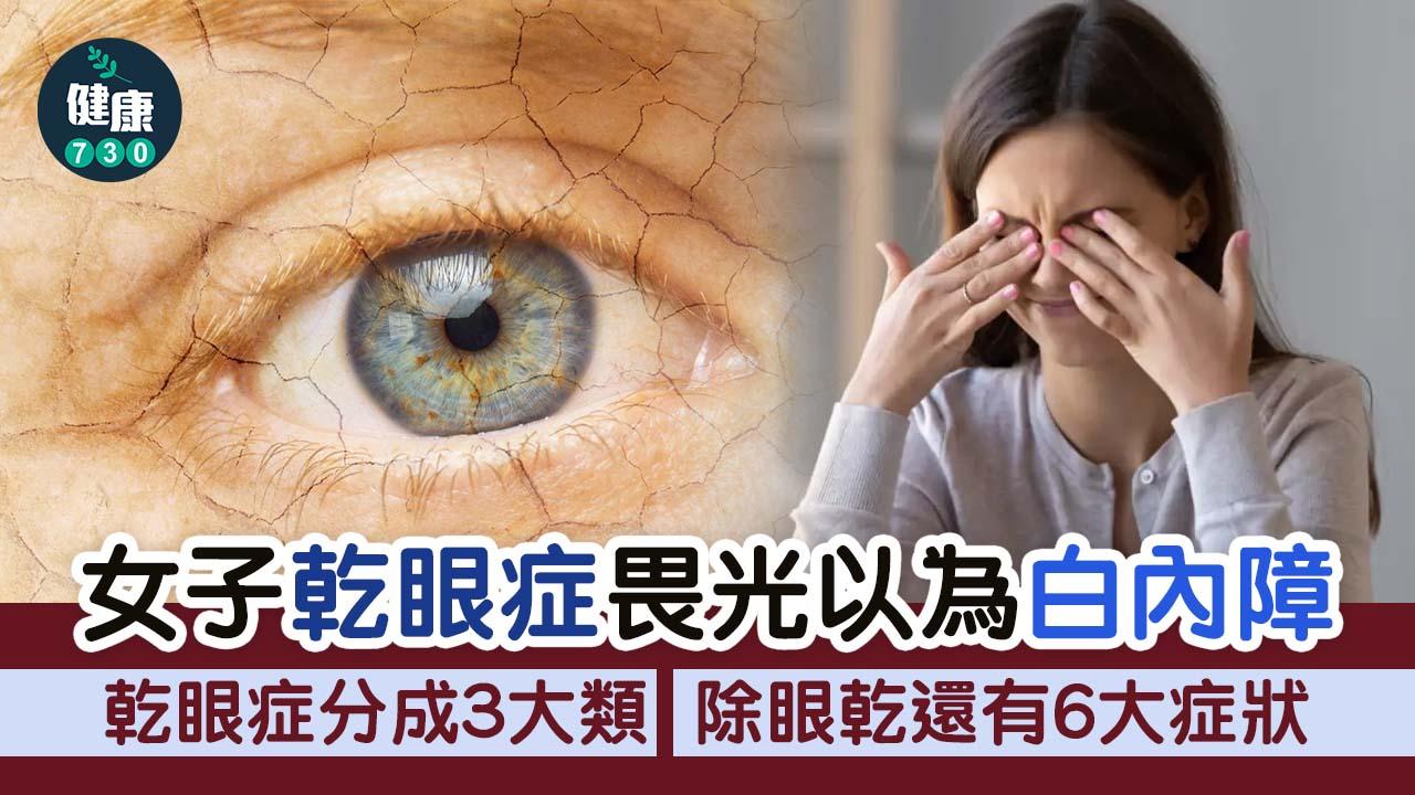 乾眼症｜女子乾眼症畏光以為白內障 除眼乾還有6大症狀