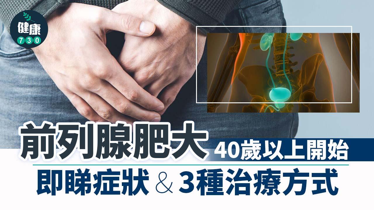 男人前列腺肥大呢個歲數開始 即睇症狀＆治療方式