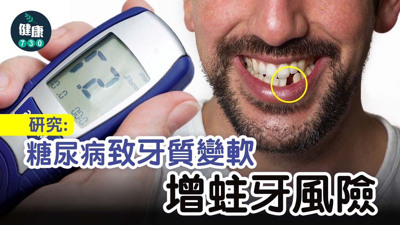 研究：糖尿病致牙質變軟 增蛀牙風險