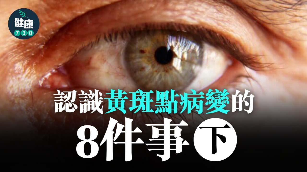 認識黃斑點病變的8件事(下)