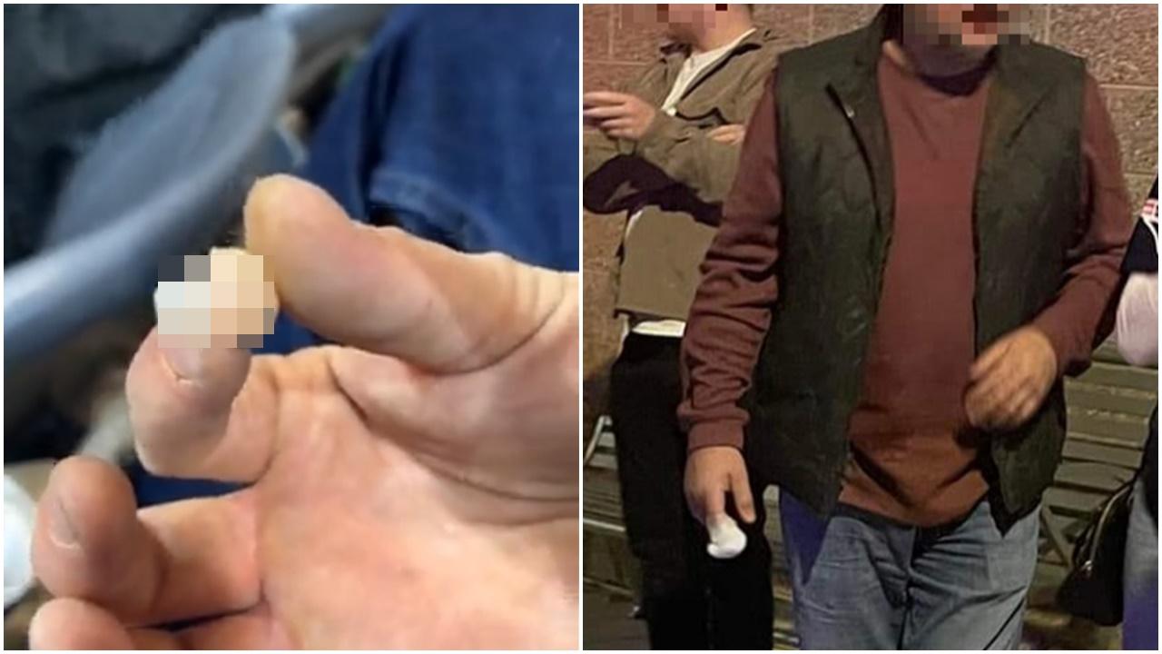 美國冰上曲棍球賽球迷毆鬥，撿被咬斷指頭問「可以做咩？」。(Twitter)