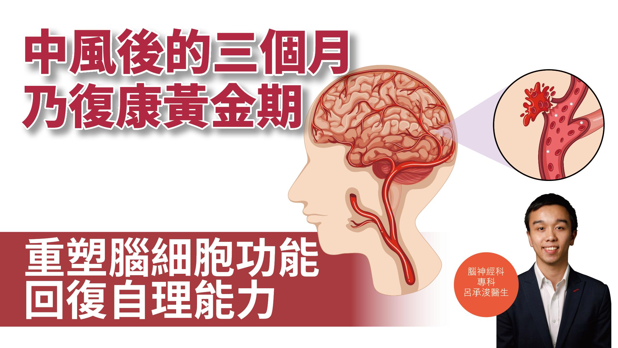 【健康解碼】中風後的三個月乃復康黃金期 重塑腦細胞功能 回復自理能力