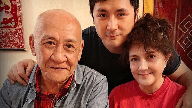 施明跌倒頭部重創 急做開腦手術留醫ICU