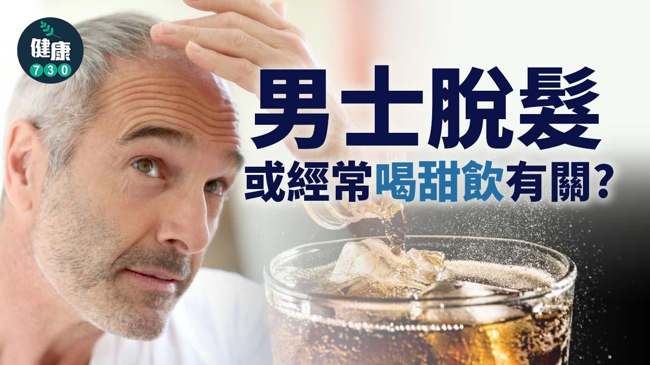 男人之苦｜雄性脫髮可能與常喝甜飲有關？