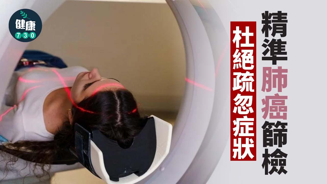 精準肺癌篩檢 杜絕疏忽症狀