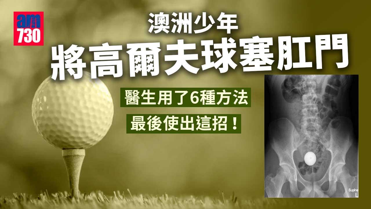 好玩唔玩｜澳洲少年將高爾夫球塞肛門　醫生用了6種方法最後使出這招