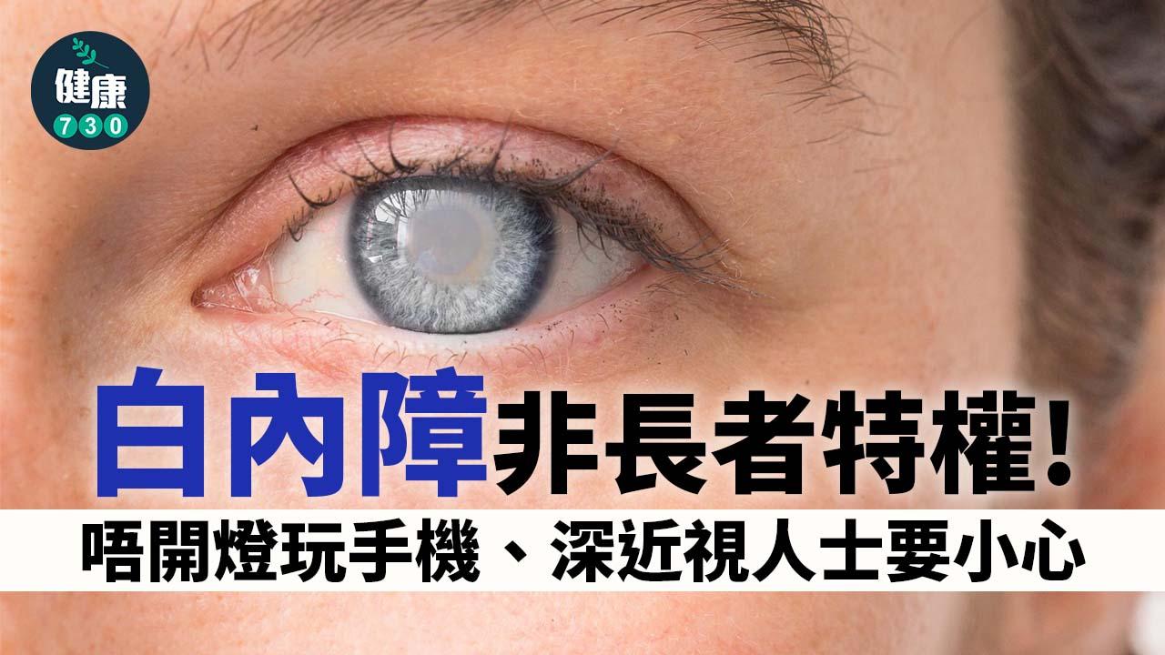 白內障非長者特權？大學生都有？深近視要小心