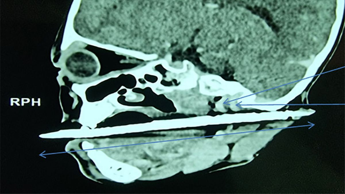 涉事髮簪。(互聯網)