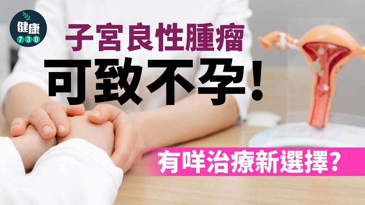 子宮良性腫瘤可致不孕 有咩治療新選擇？