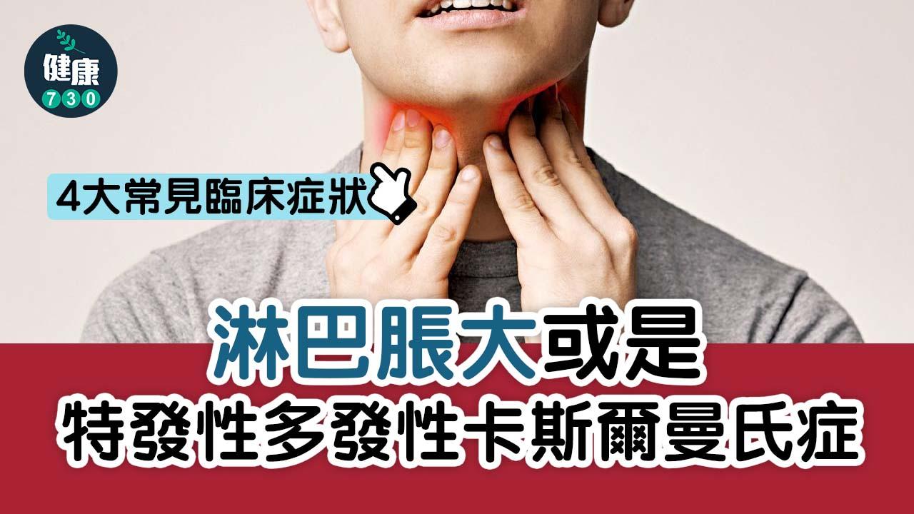 淋巴脹大或是特發性多發性卡斯爾曼氏症