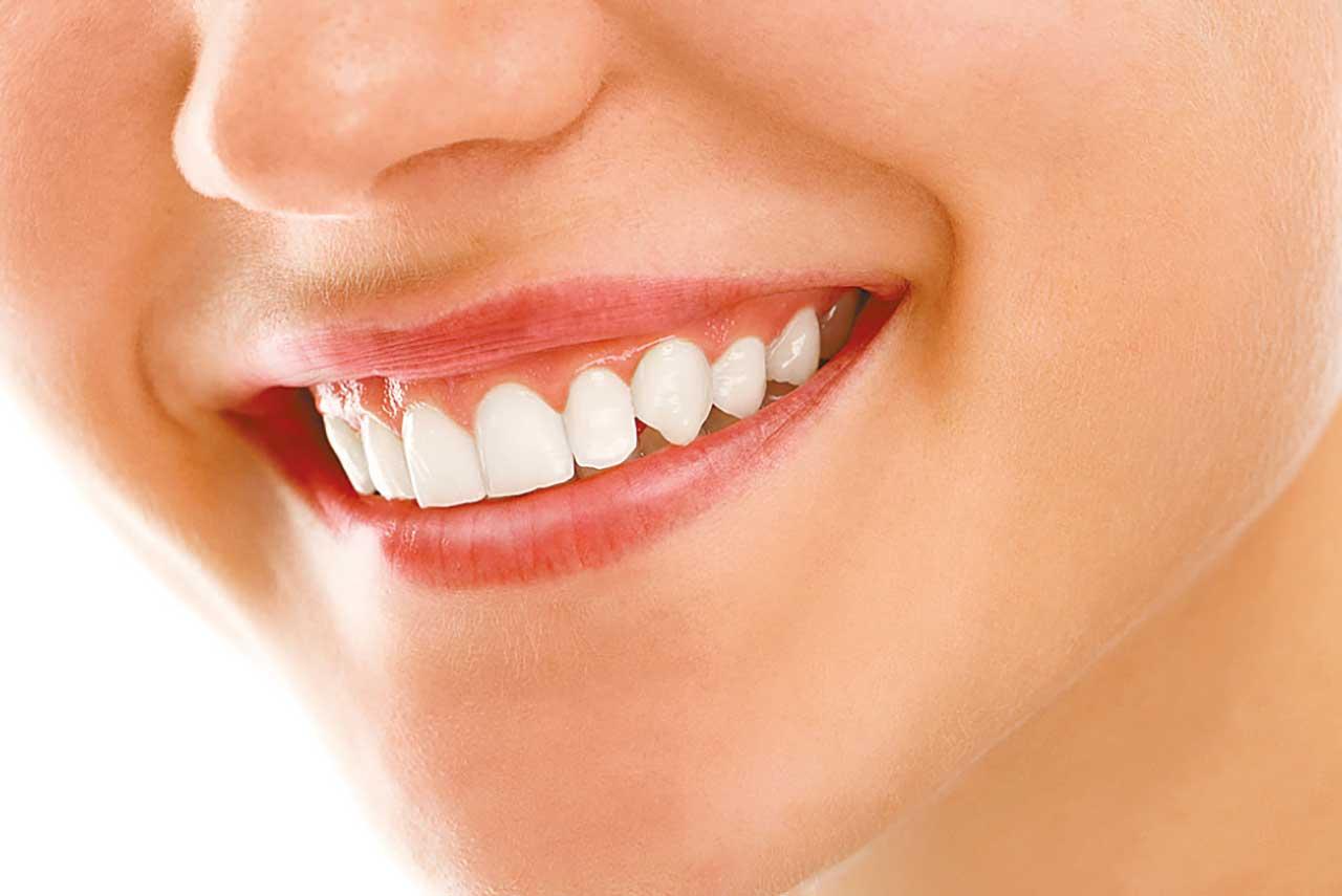 想展露迷人笑容？先從維護口腔健康做起