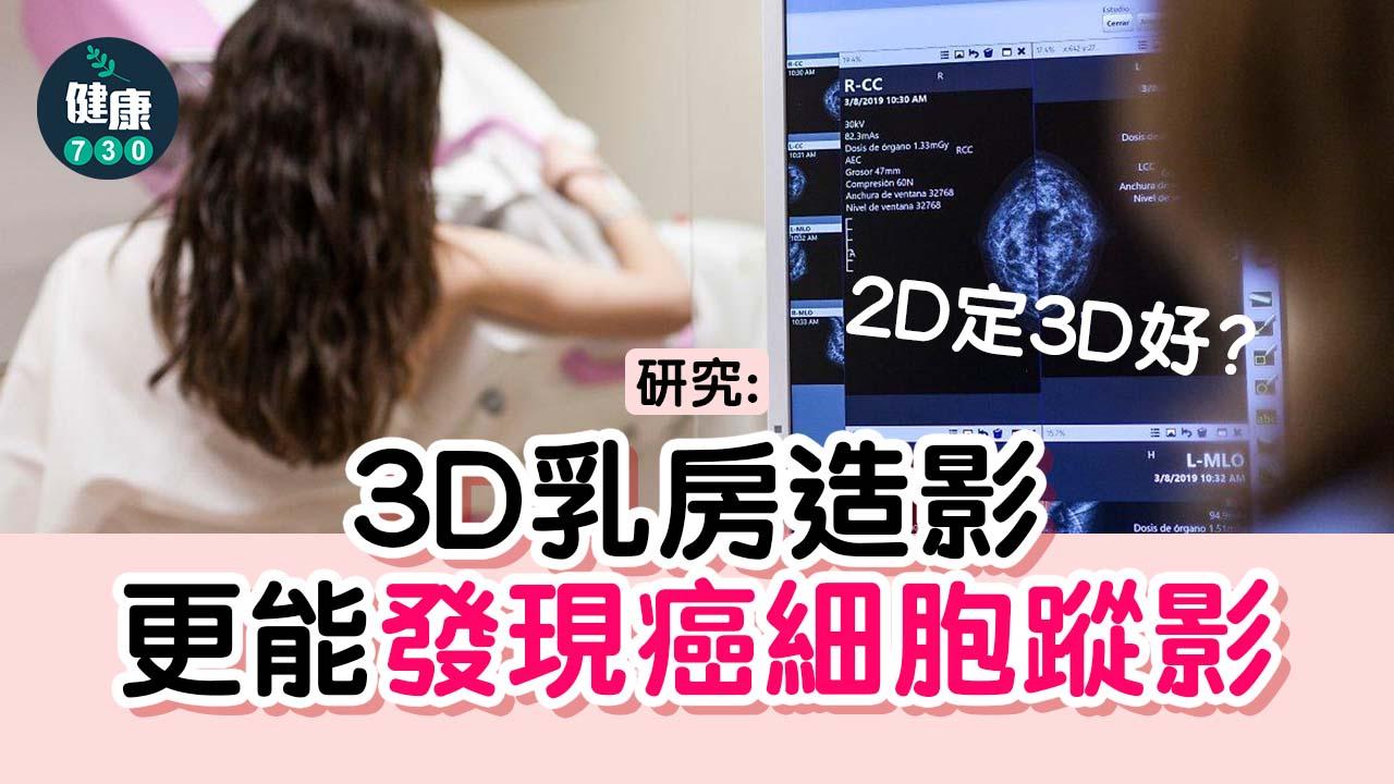 2D定3D好？ 研究：3D乳房造影更能發現癌細胞蹤影