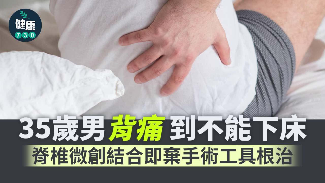 35歲男背痛到不能下床 脊椎微創結合即棄手術工具根治