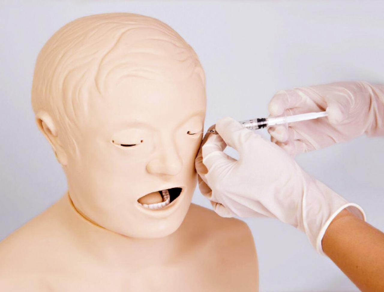 鼻淚管閉塞的治療(上)