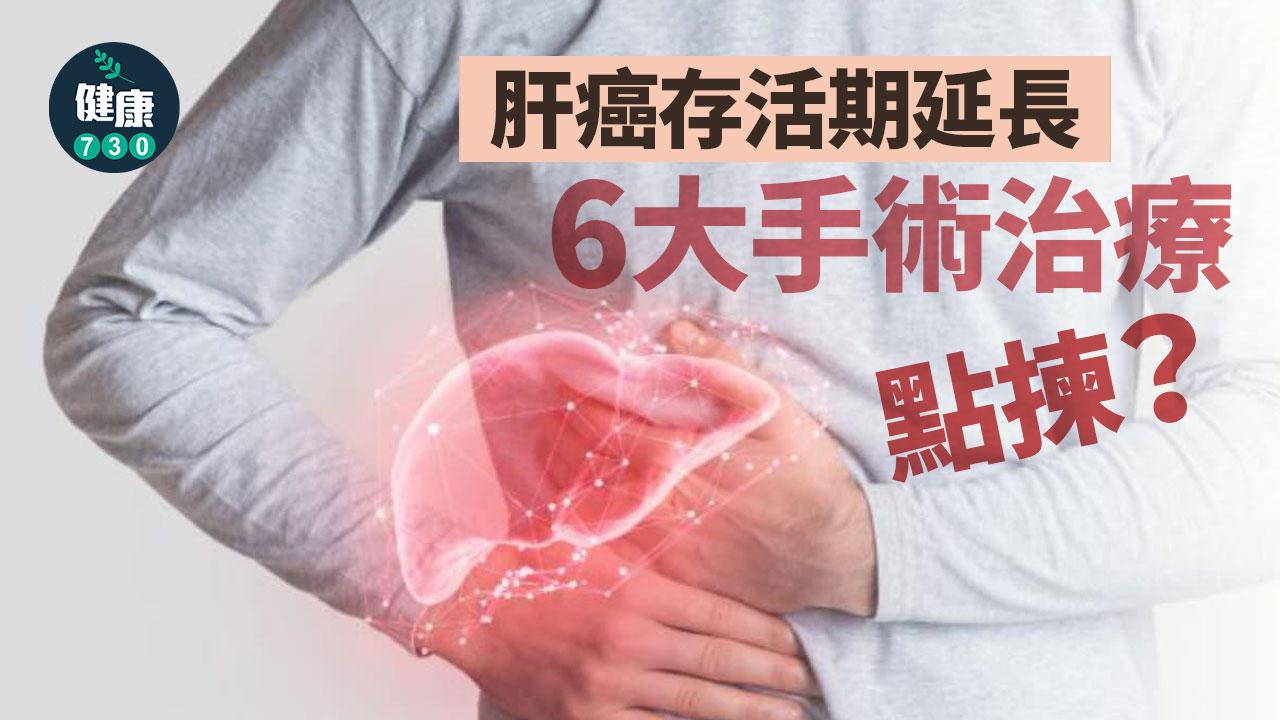 肝癌存活期延長 6大手術治療點樣揀？