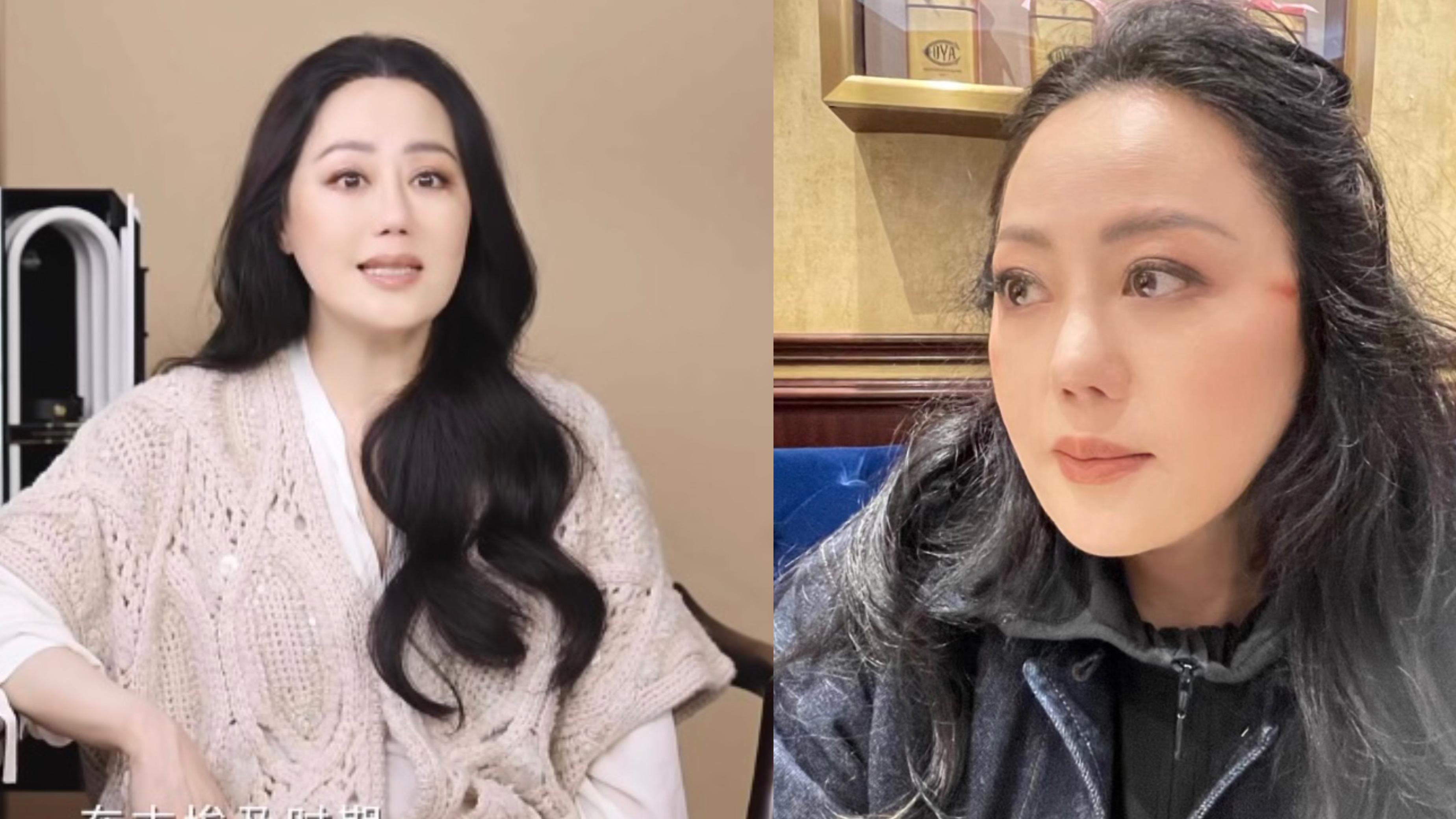 59歲章小蕙慘遭電髮棒燙傷 臉上留紅色疤痕