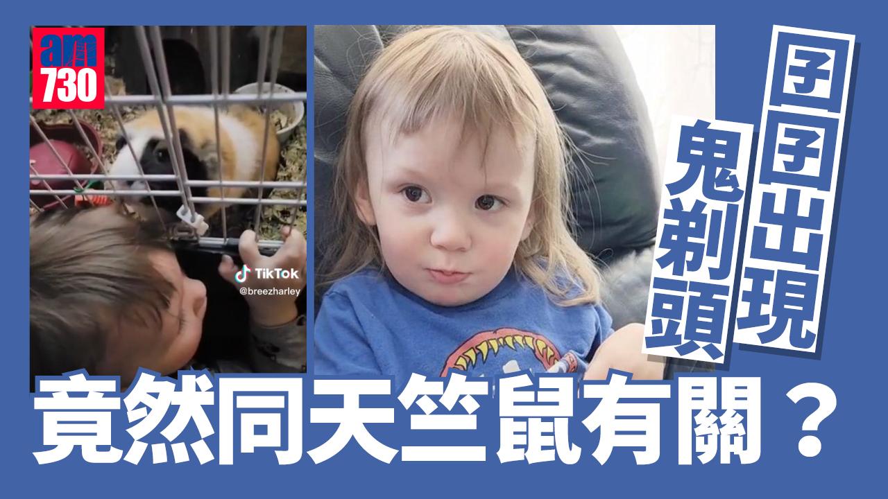 兒子年紀小小出現「鬼剃頭」 罪魁禍首竟是「牠」