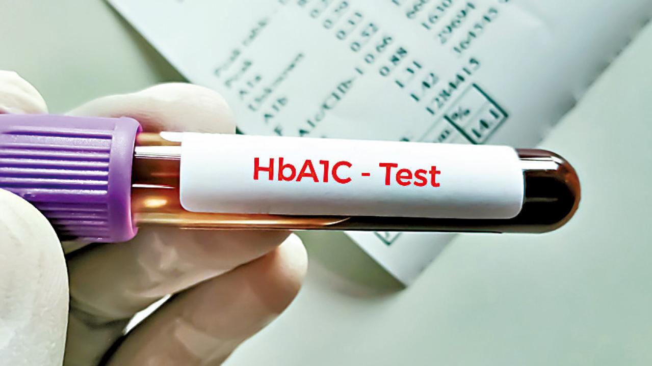 血糖與糖化血色素(HbA1c)