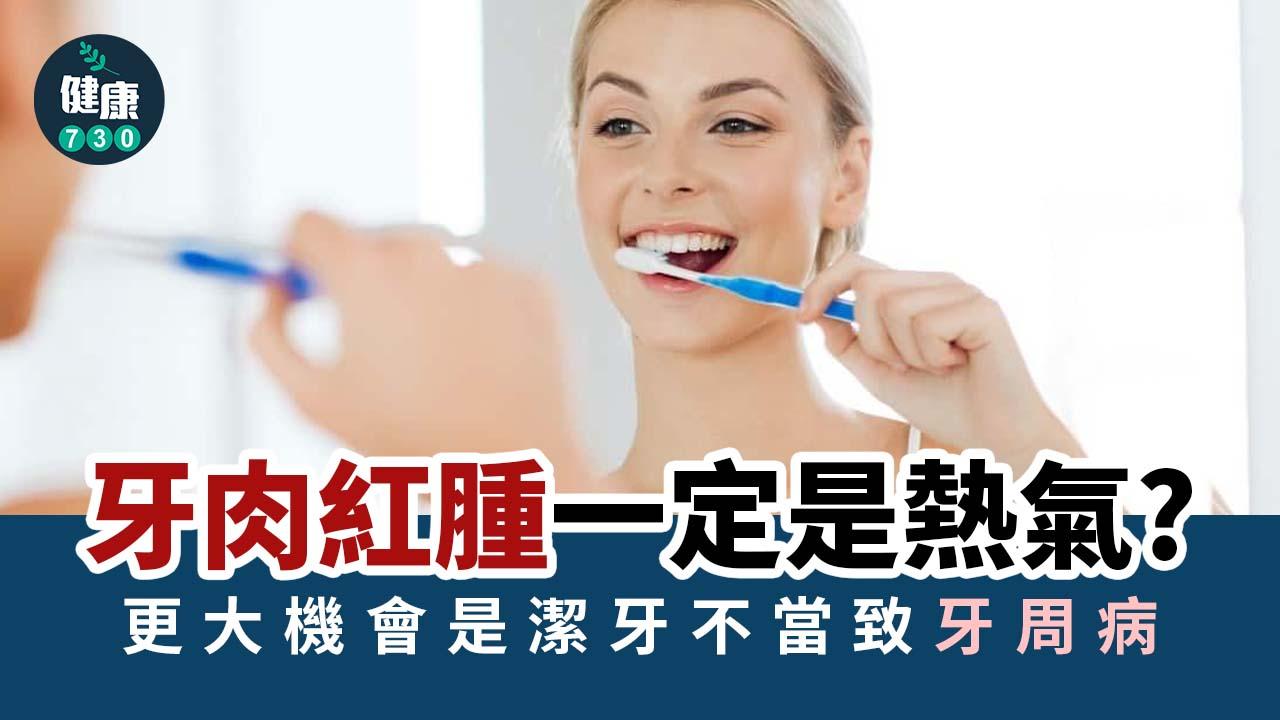 牙肉紅腫一定是熱氣 更大機會是潔牙不當致牙周病