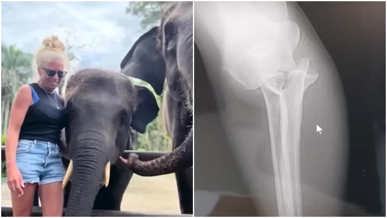 與大象合照手臂被咬斷，峇里島女遊客：聽到骨碎聲。(YouTube)