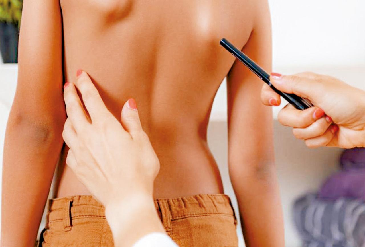 人工智能輔助脊柱序列評估和患者院外管理