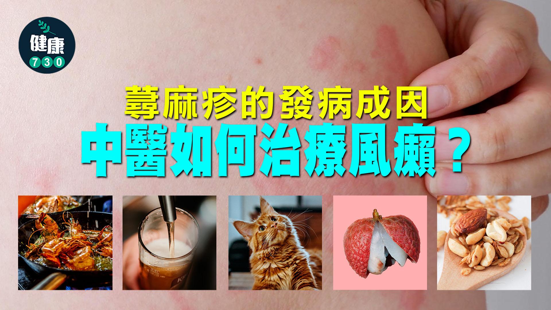 蕁麻疹的發病成因　中醫如何治療風癩？