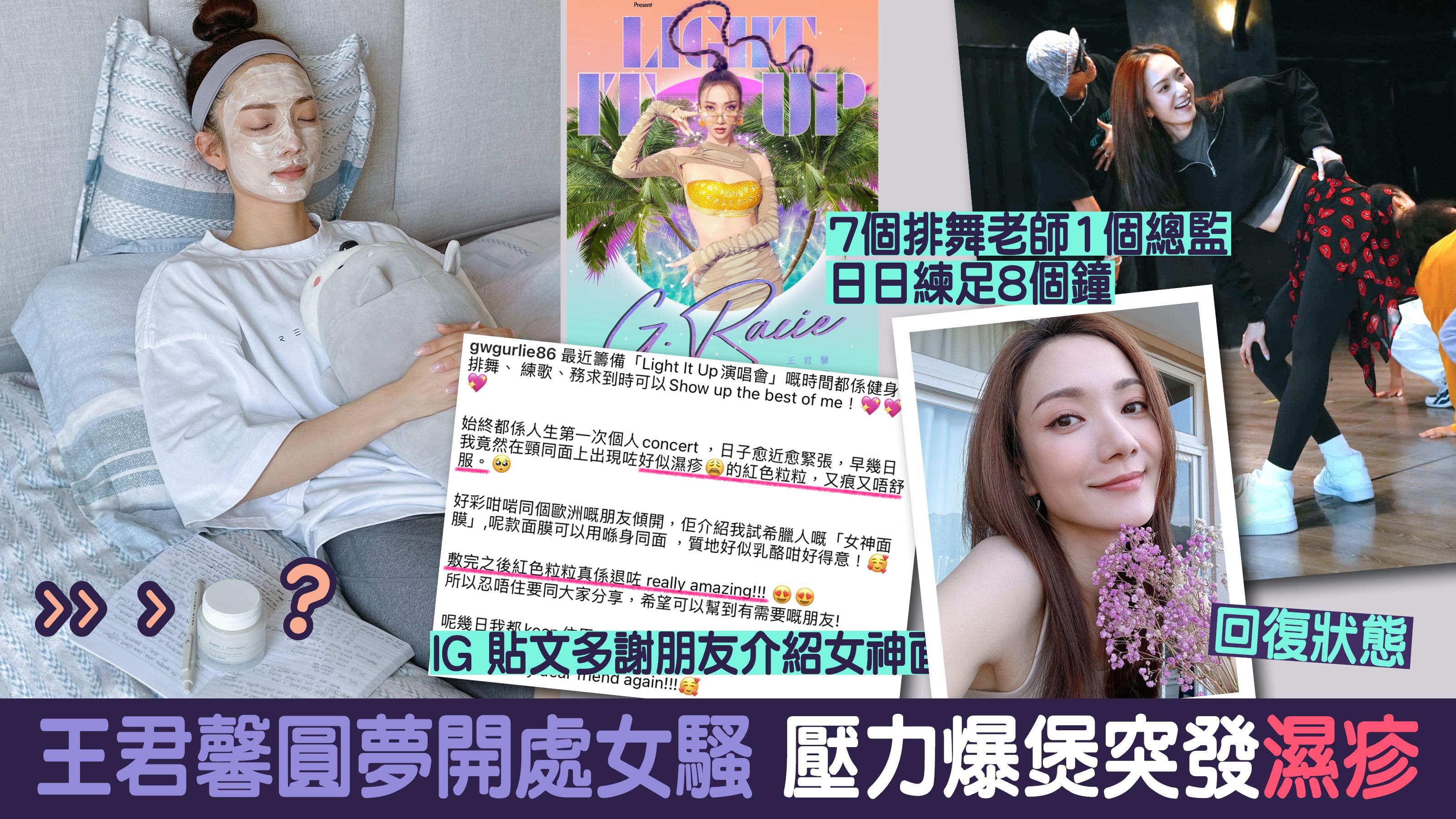 王君馨處女騷前夕突發濕疹 多得友人介紹「女神面膜」回復最佳狀態