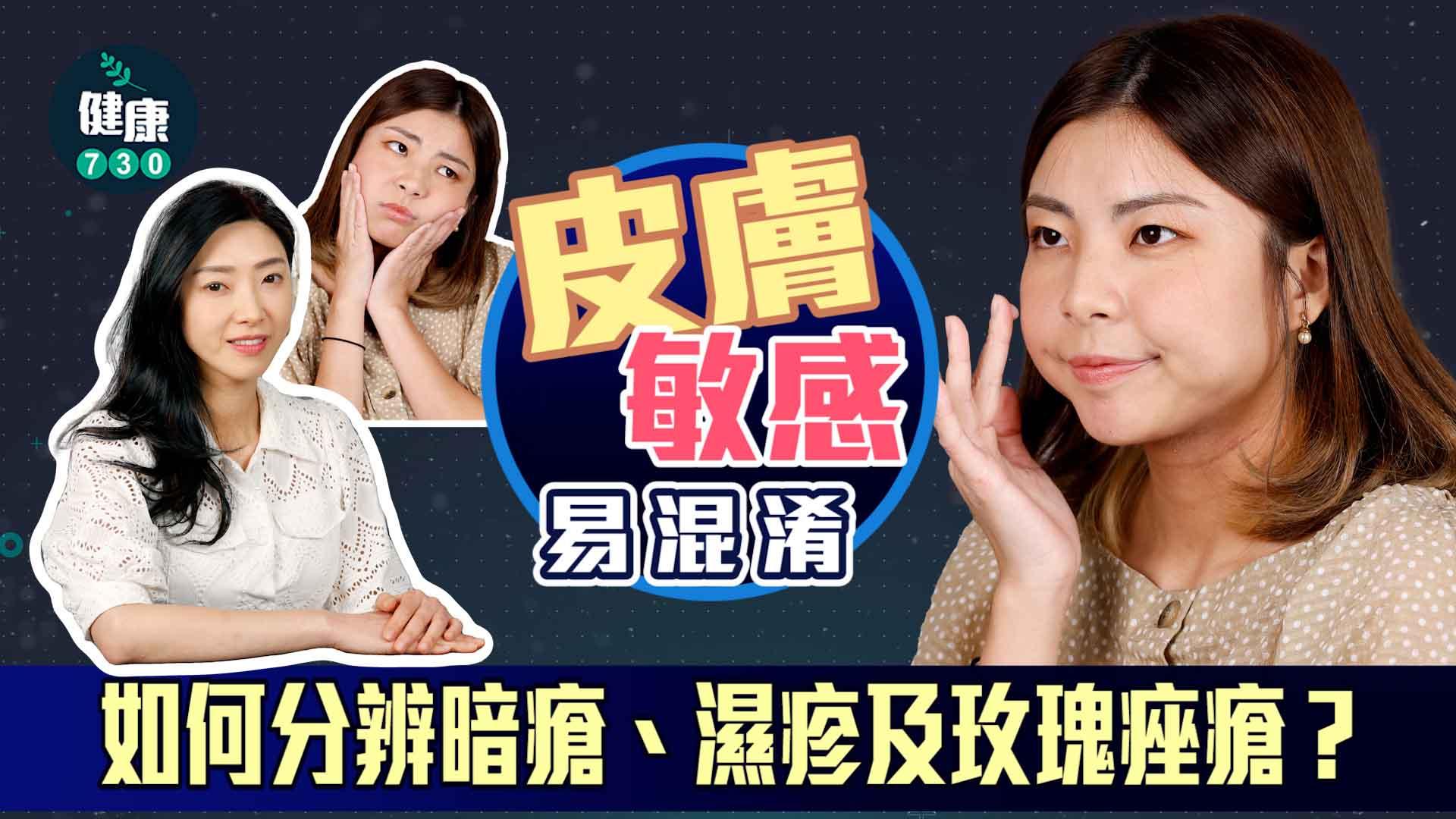 皮膚敏感易混淆 如何分辨暗瘡、濕疹及玫瑰痤瘡？