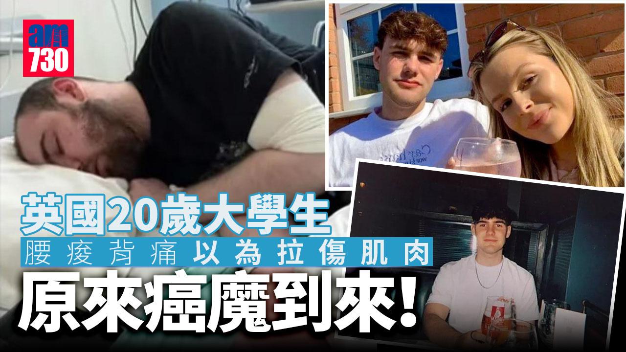 20歲大學生腰酸背痛以為拉傷肌肉 原來癌魔到來