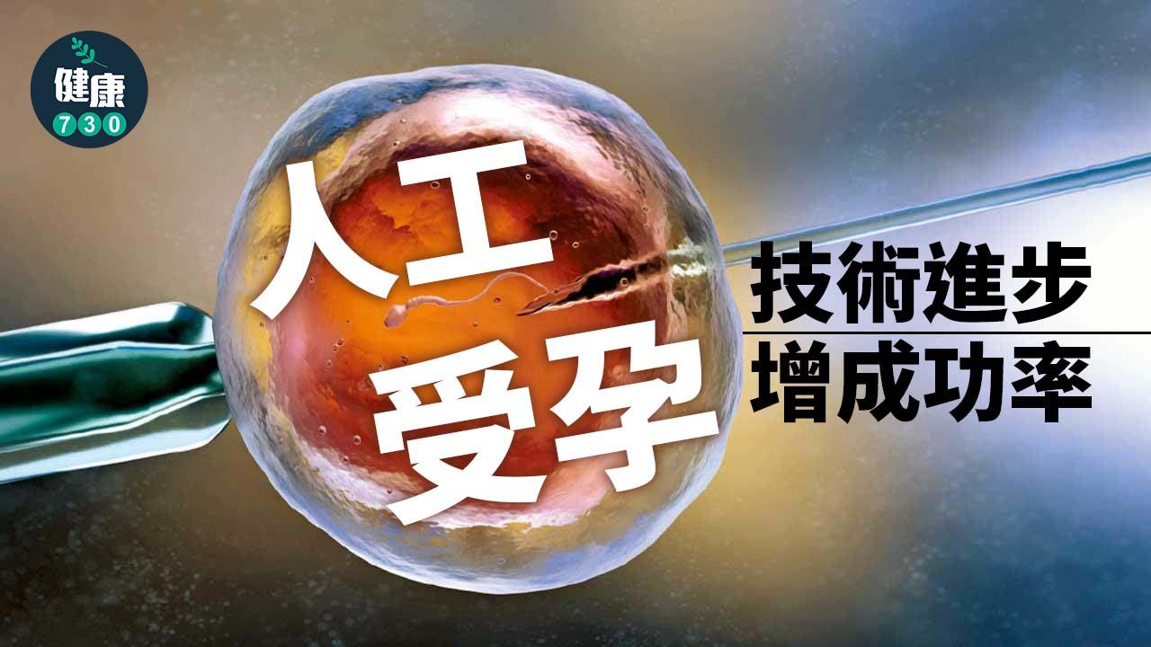 人工受孕｜技術進步增成功率