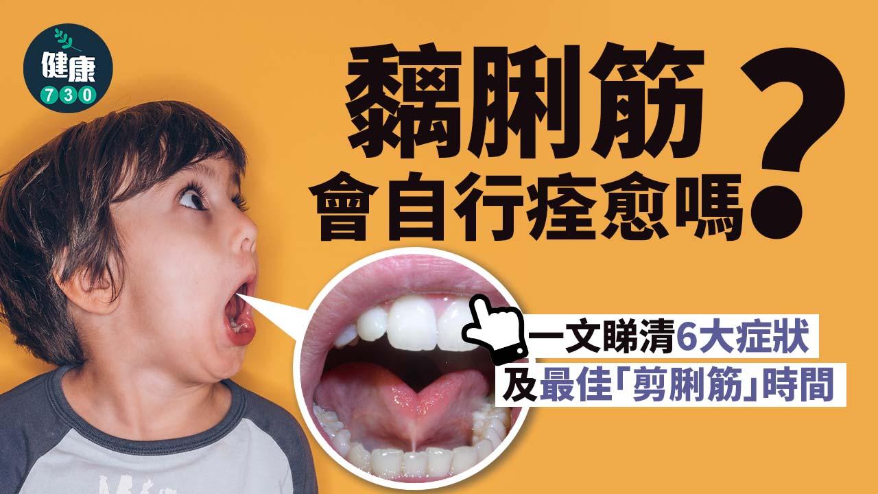 小朋友黐脷筋只係講嘢有問題？一個方法冇手尾跟