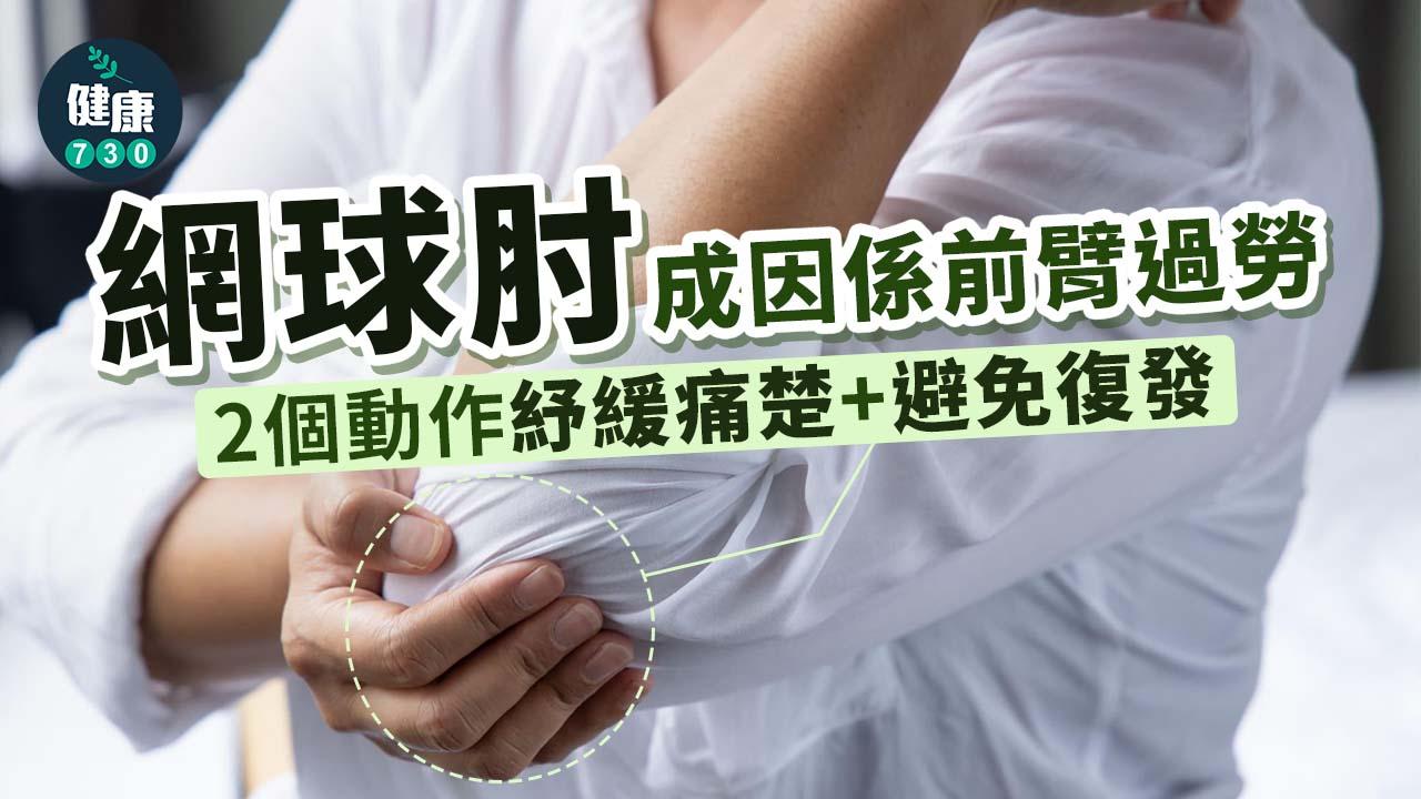 網球肘｜成因係前臂過勞 伸展+1招運動預防翻發