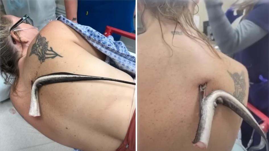 奧布萊恩背部插著魔鬼魚尾刺，畫面嚇人。(互聯網)