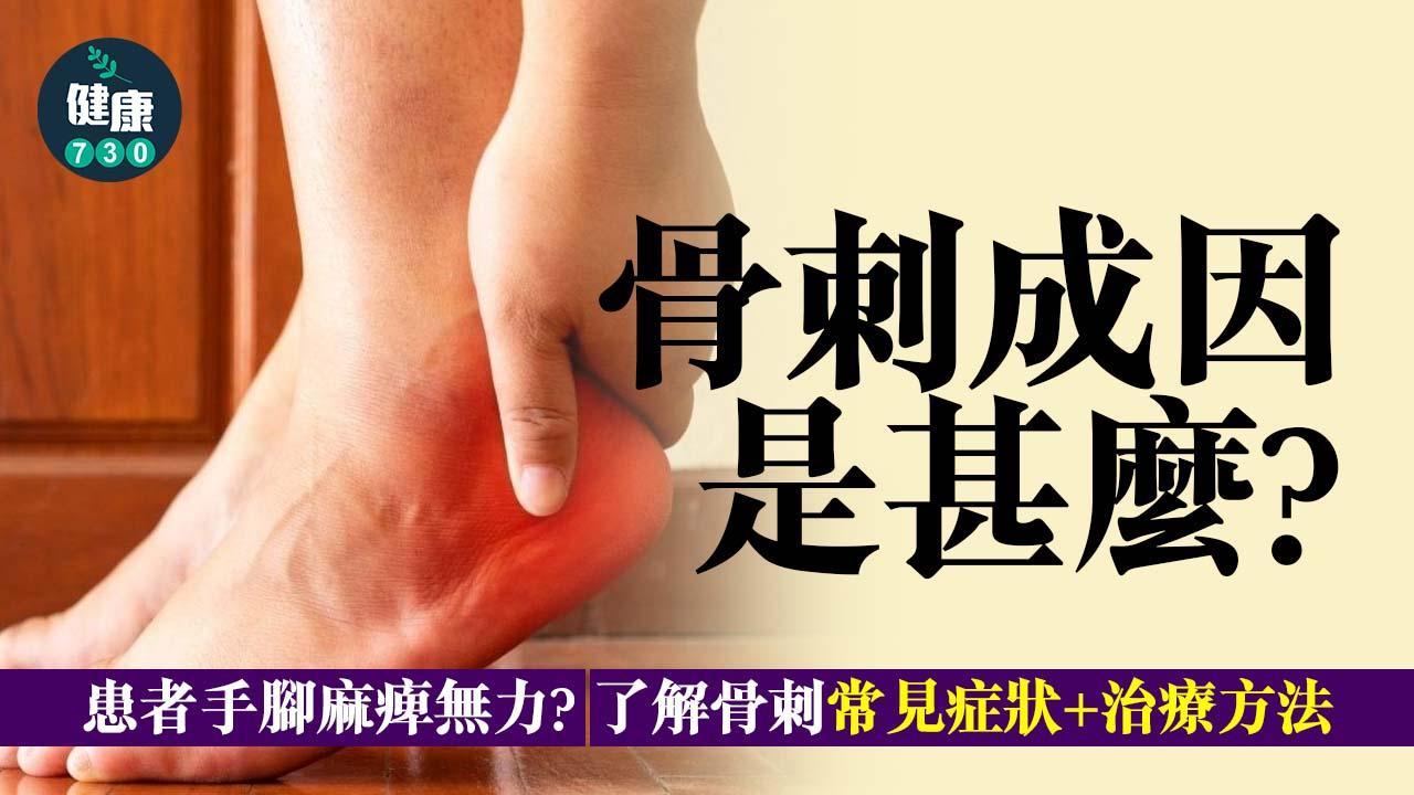 骨質增生｜生骨刺是甚麼？一文了解骨刺成因、症狀及治療方法