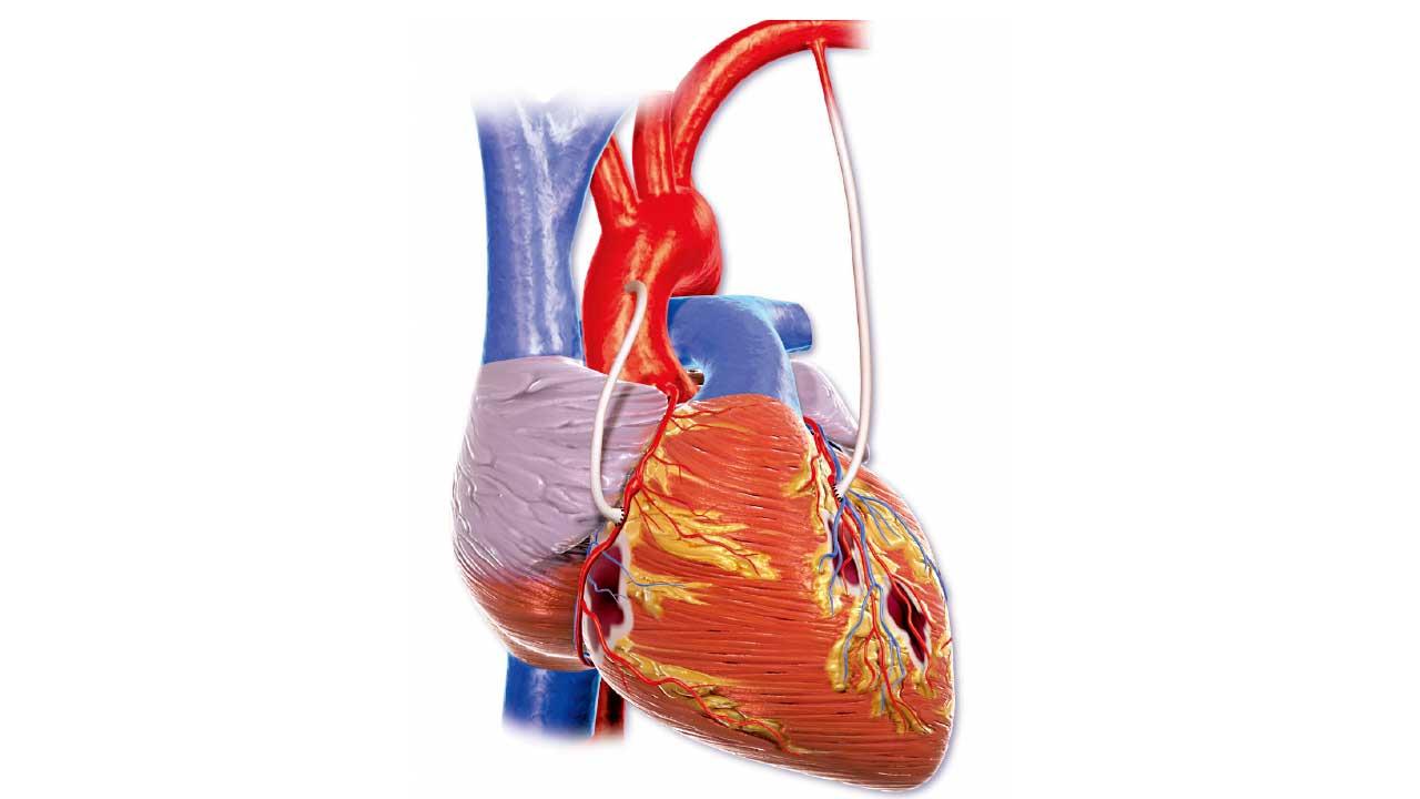 通波仔大進步 兩種情況仍須搭橋