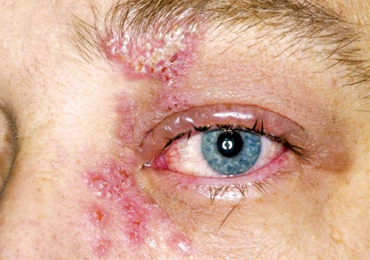 眼睛也可以生蛇