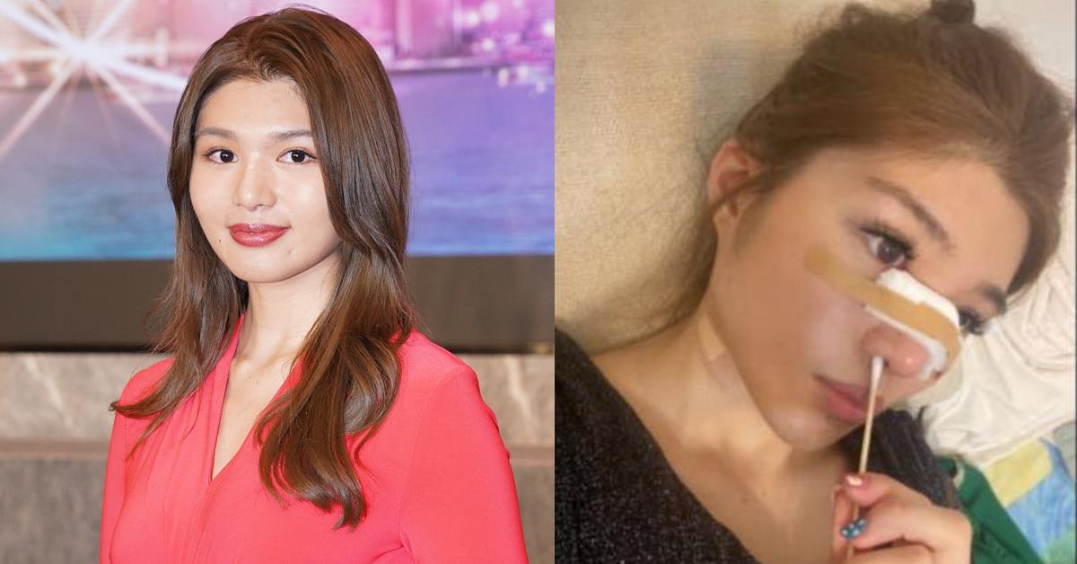 香港小姐2023｜潘明璇否認整容 辯稱踩單車整親鼻