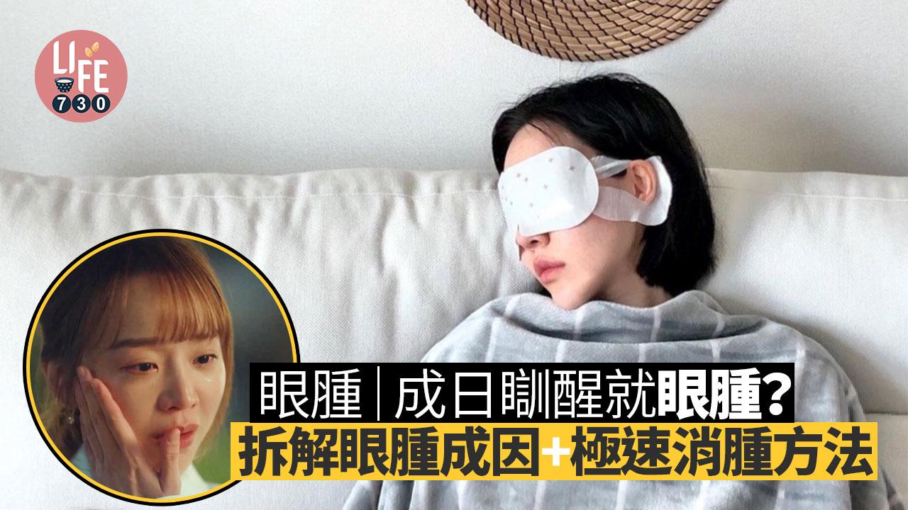 眼腫｜成日瞓醒就眼腫？！拆解眼腫成因+ 極速消腫方法