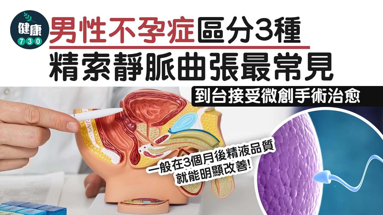 不育｜精索靜脈曲張致不育 到台接受微創手術治愈
