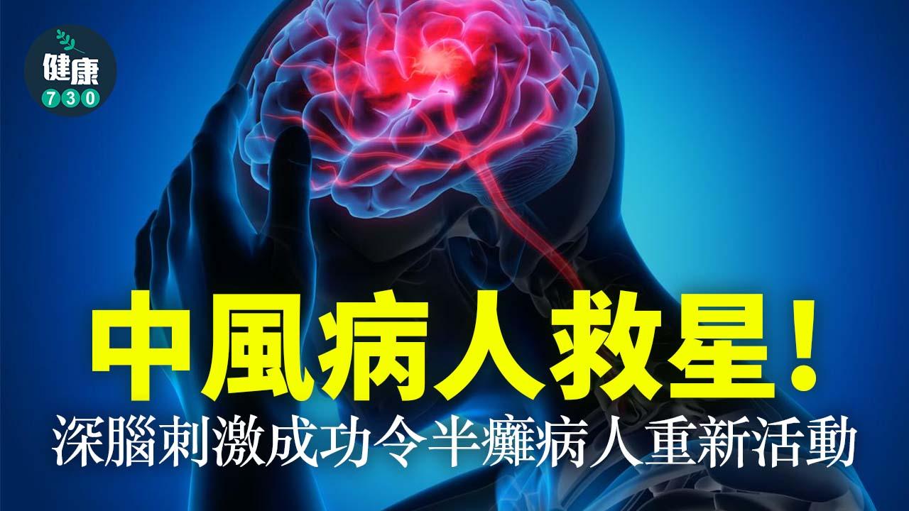 中風病人救星 深腦刺激成功令半癱病人重新活動