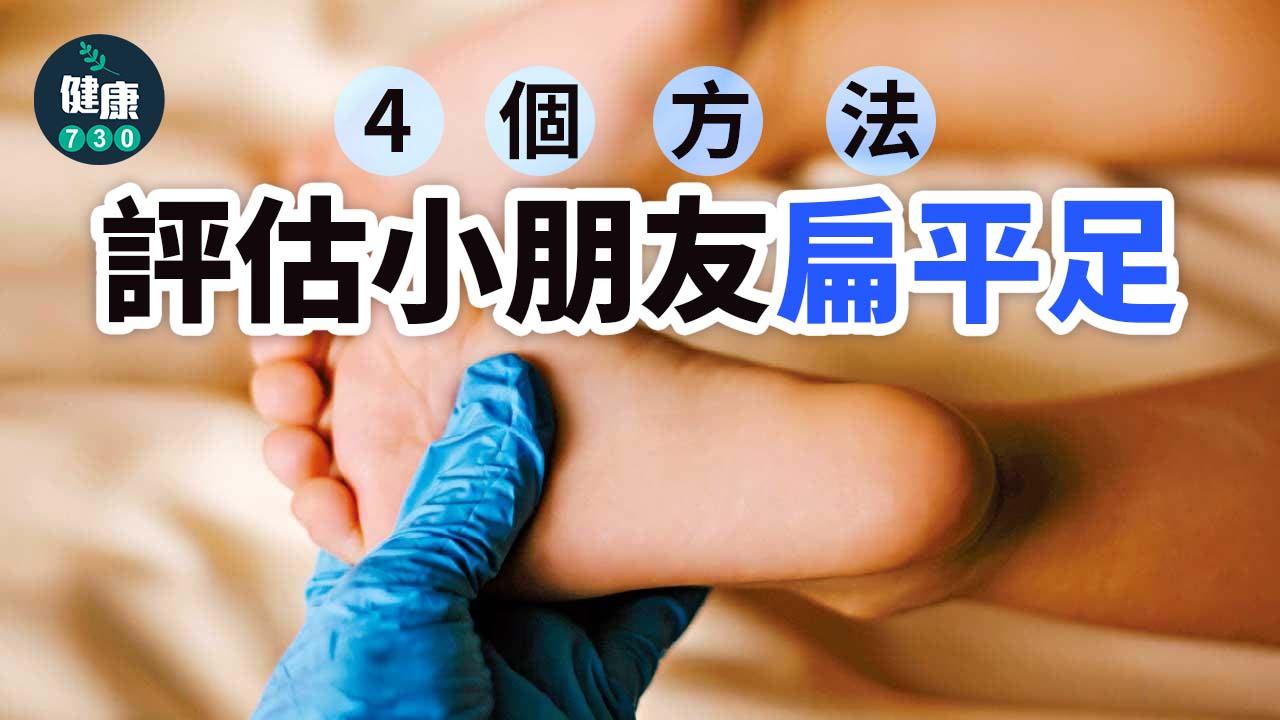 扁平足判斷｜4個簡單方法 評估孩子扁平足