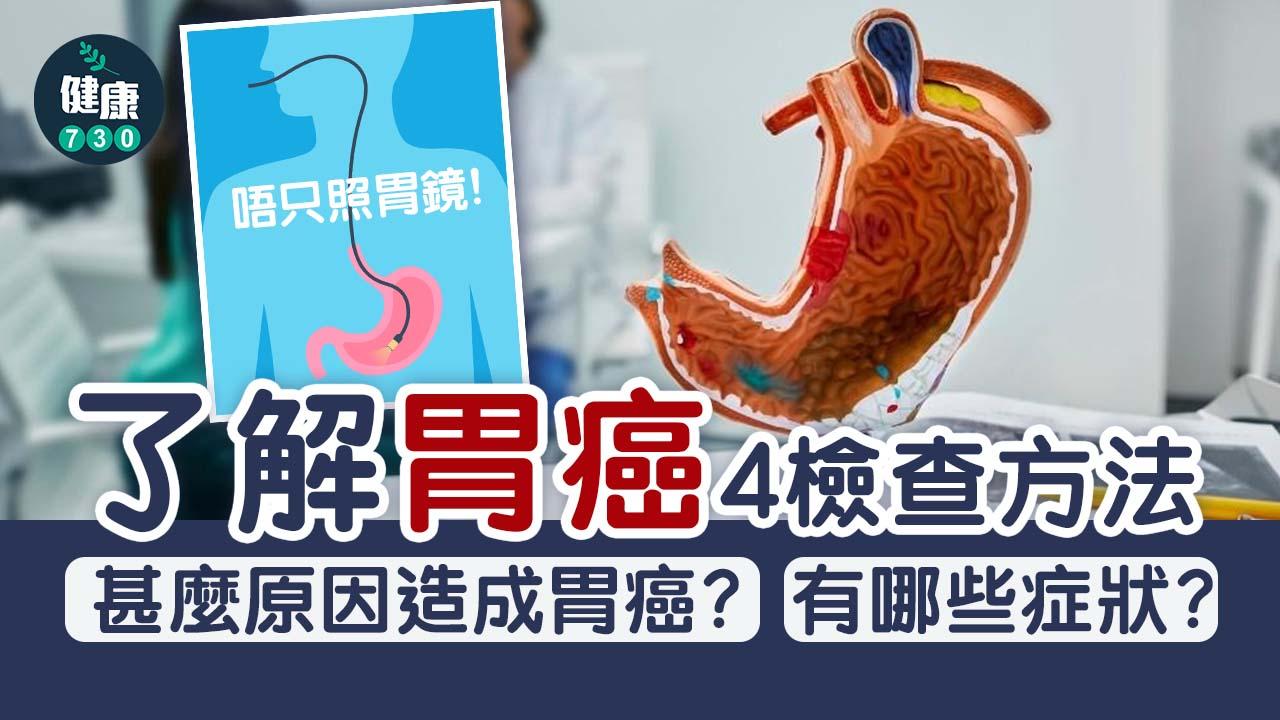 胃癌｜胃癌唔只照胃鏡！了解4檢查方法 有呢啲警號要即求醫