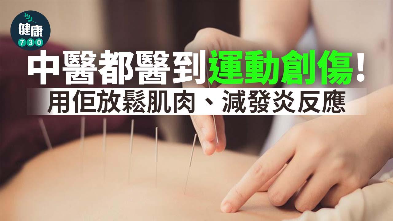 中醫都醫到運動創傷！用佢放鬆肌肉、減發炎反應