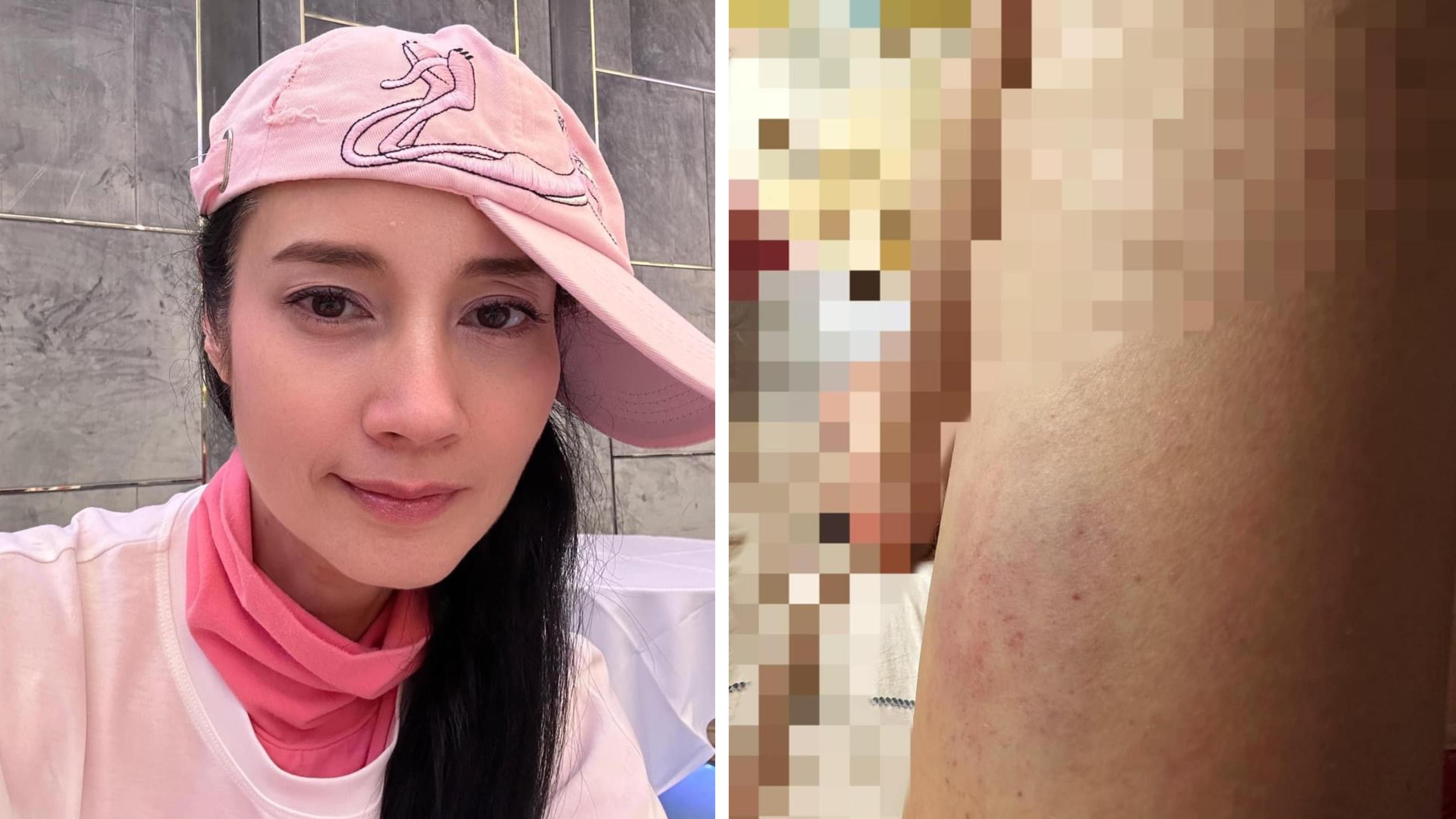 鄭艷麗病情反覆，直言唔知可以撐得幾耐。