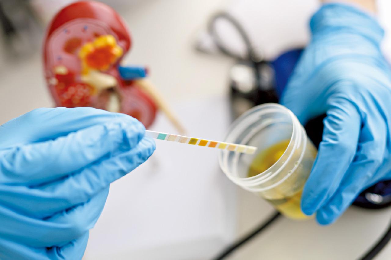 定期篩查慢性腎病 避免洗腎
