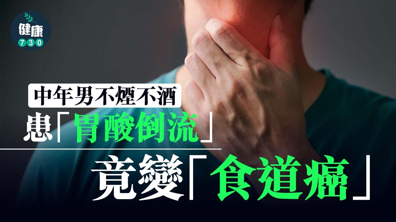 胃酸倒流｜中年男不煙不酒 患「胃酸倒流」竟變「食道癌」