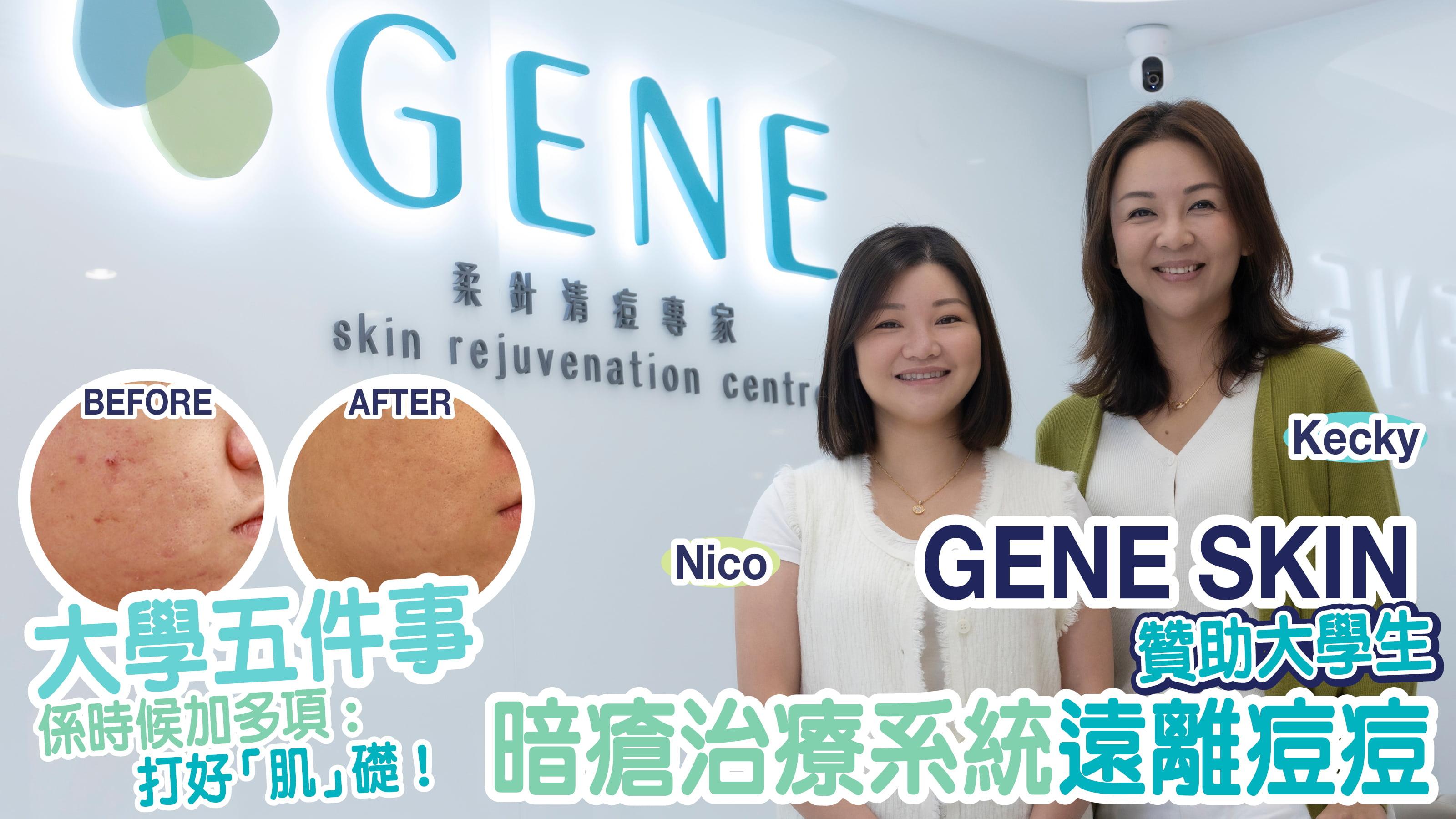 GENE SKIN暗瘡治療系統告別痘痘肌 讀U趁早打好「肌」礎 社交見工第一印象大加分